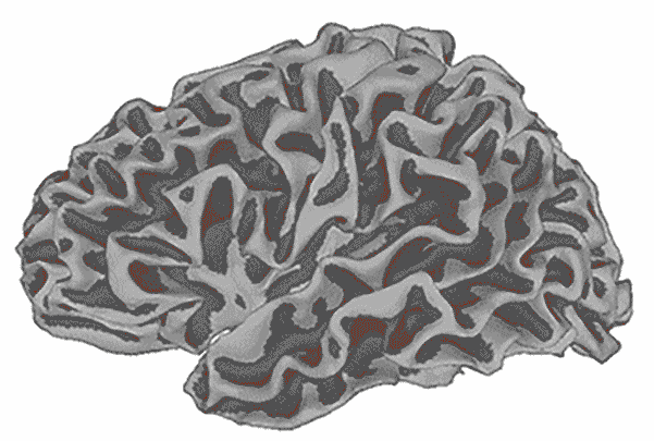 Animated brain scan