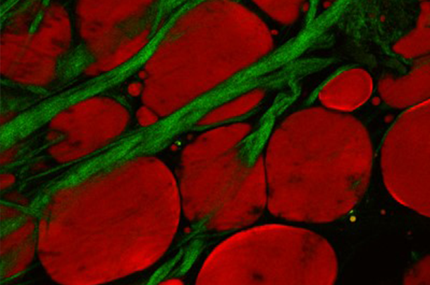 Microscopic slide of red and green lipids and collagen