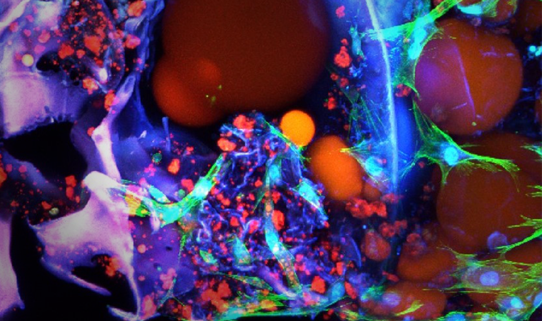 Microscopic image of fat cells
