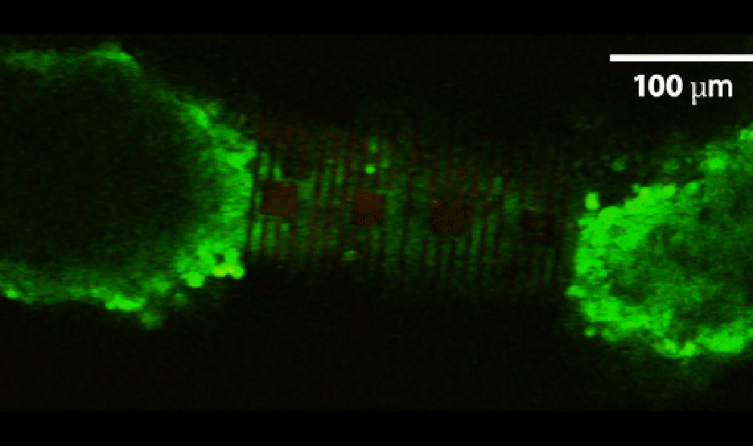Imaging of calcium ion activity