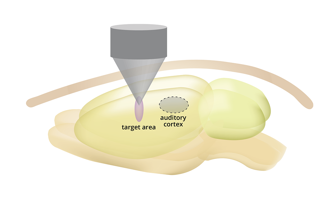 Technical image showing the target area and auditory cortex