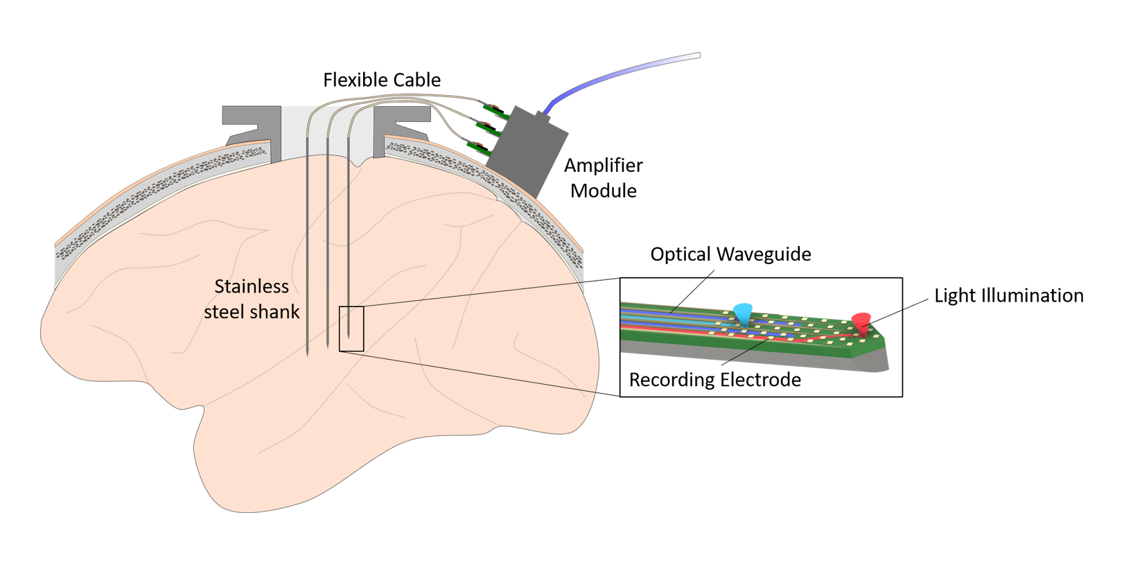 diagram of steeltrodes