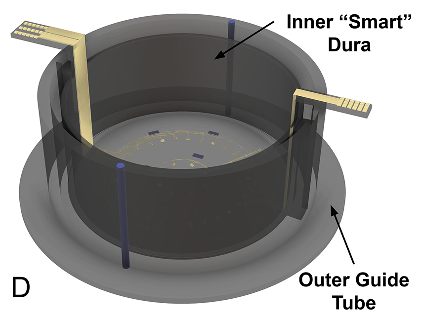Inner "smart" dura and outer guide tube