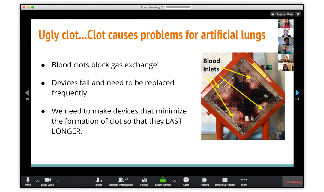 Slide from the zoom call on blood clots