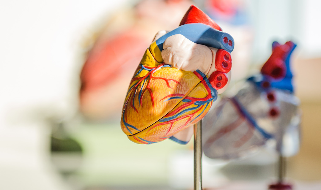 Model of a human heart