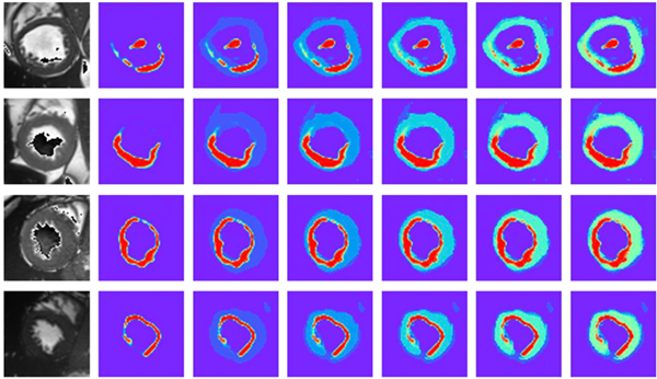 Technical graphic showing cardiac image segmentation