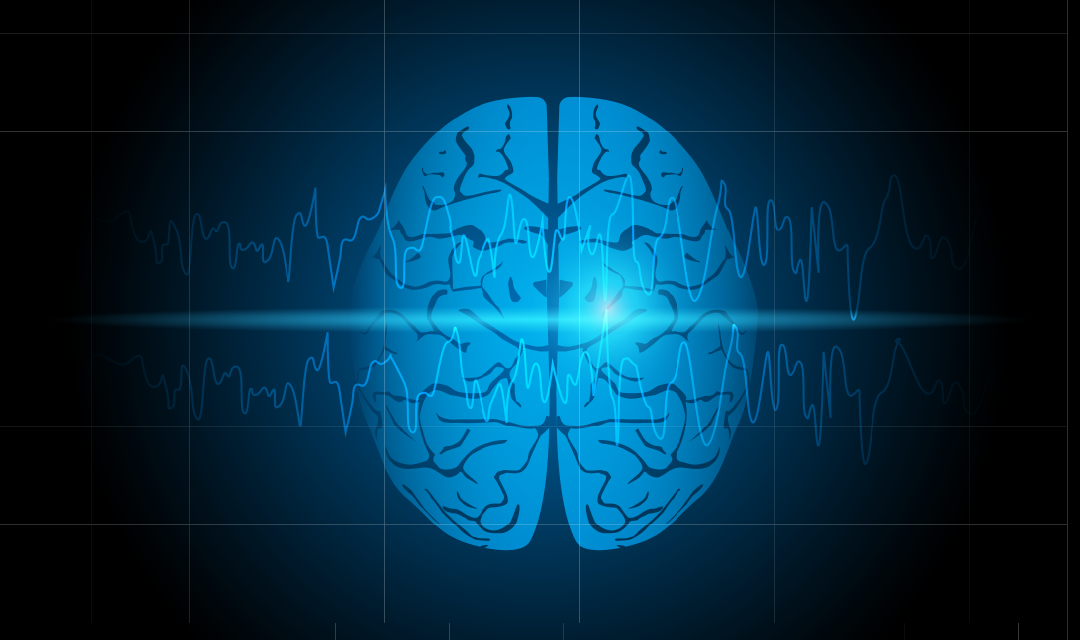 Clipart of brain with brain monitor waves