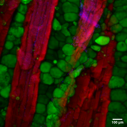 Cell slide of meat tissue