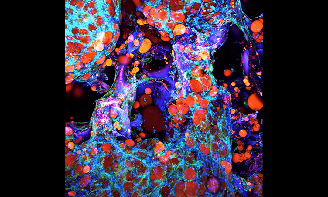 3D rendering of fat tissue