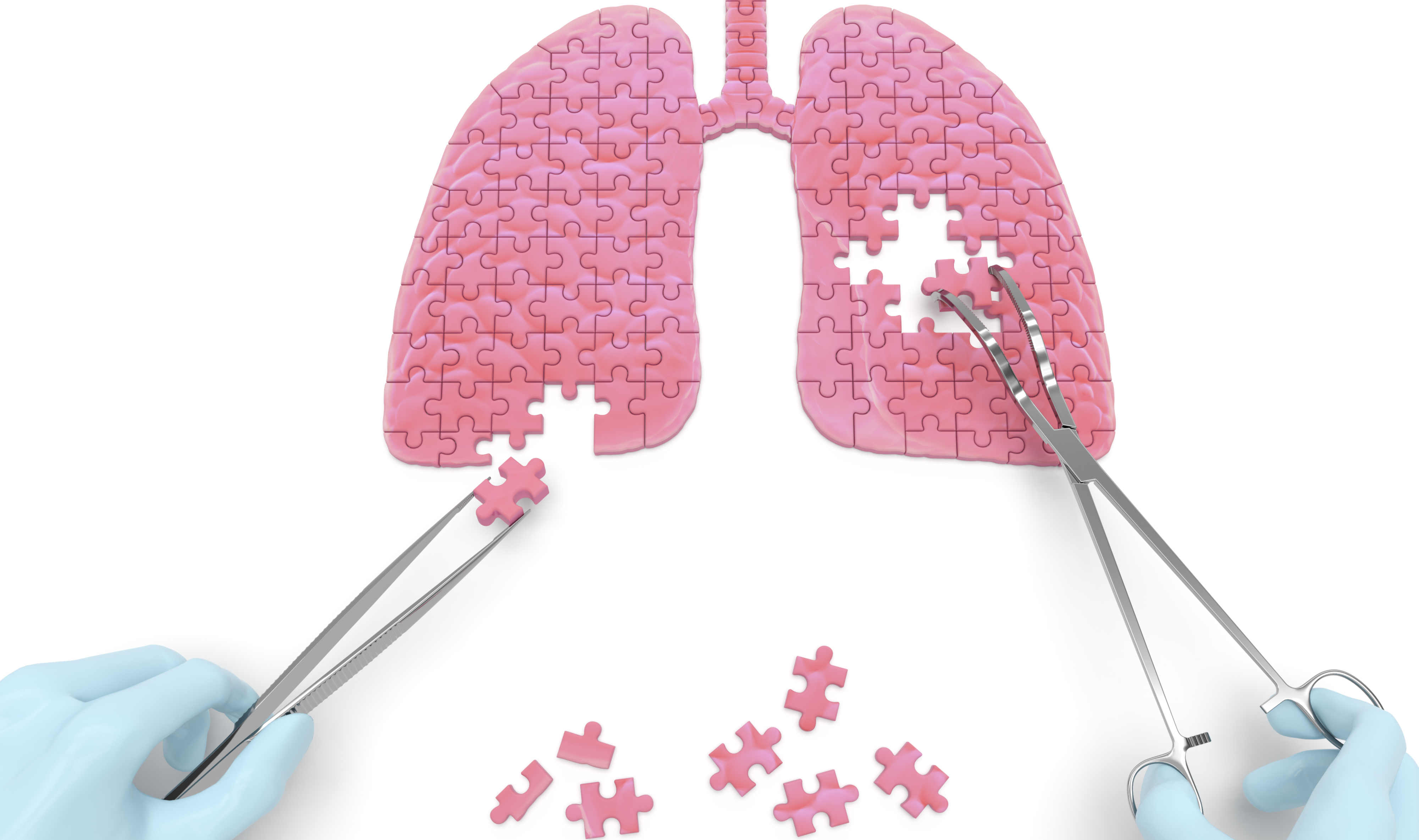 Gloved hands putting together a puzzle that looks like lungs