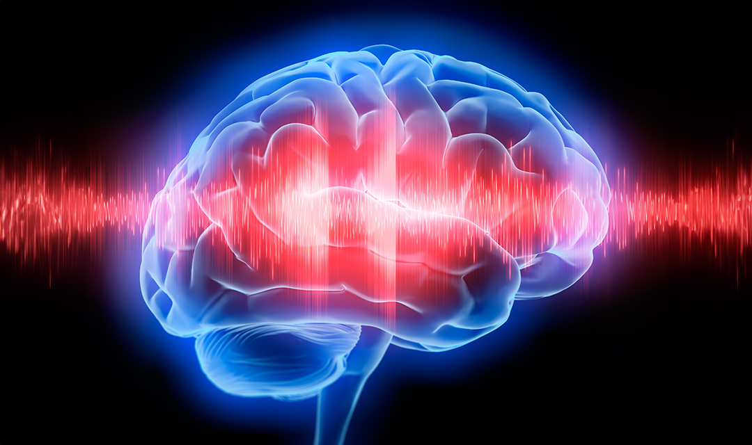 Artistic rendering of the brain with sound waves