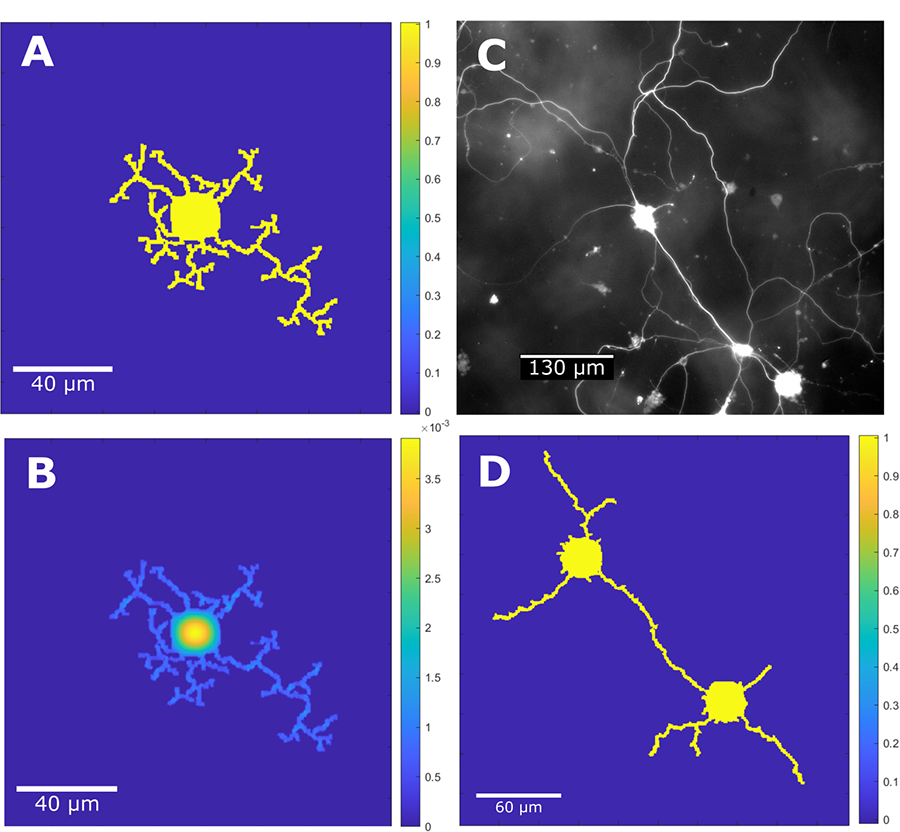 Four slides of cell growth. A shows tight growth,  B shows more growth at the neuron, C is a black and white image showing the actual cells, and D has a lot of growth between neurons.