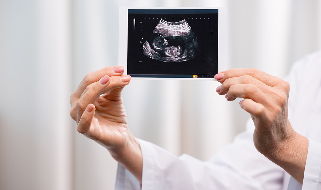 A doctor holding an ultrasound