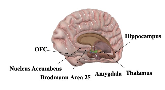 By targeting the brain’s “reward circuit” (the orbitofrontal cortex, Brodmann area 25, amygdala, etc.) and managing environmental and time of day factors, DeepFocus could disrupt the brain’s associations with cravings. This could help treat neural conditions like addiction and substance abuse disorder.