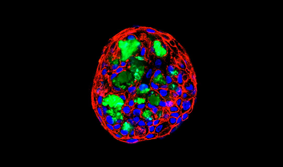 Scan of a brain with certain parts lit up