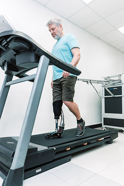 person with a prosthetic leg walks on a treadmill