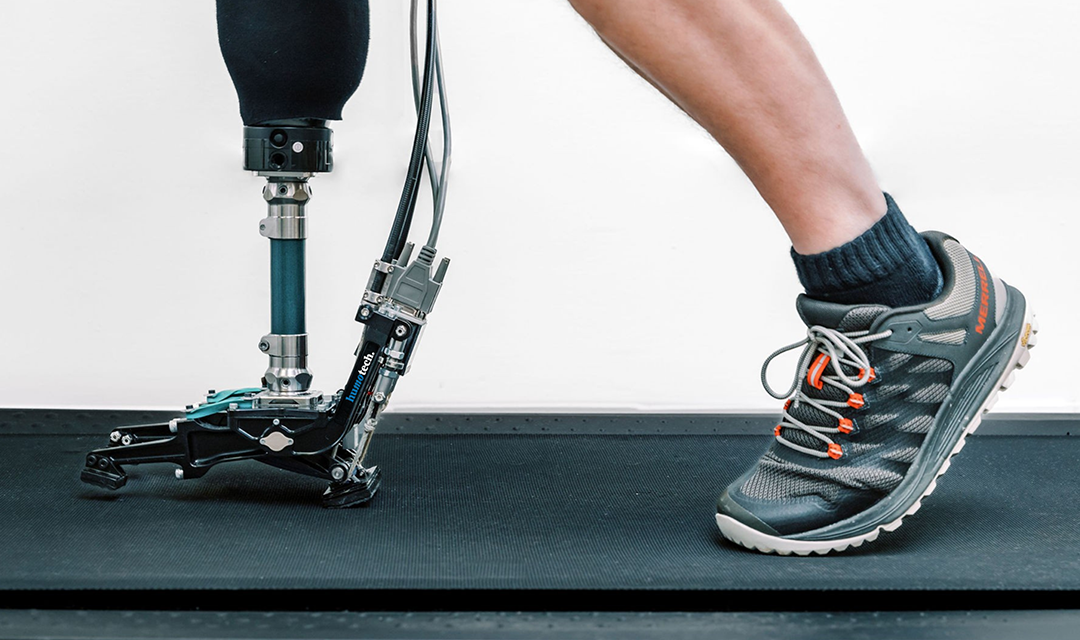 Prosthetic foot and foot with sneaker walking on a treadmill