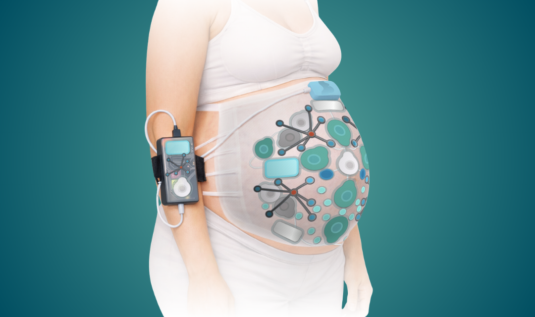 Illustration of a pregnant belly wearing a sensor belt connected to a small monitoring device on the arm, suggesting prenatal monitoring technology.