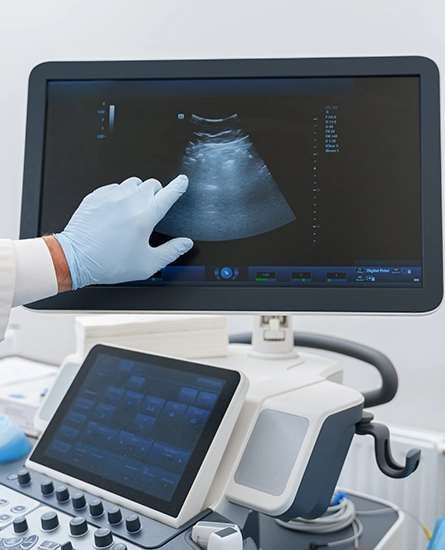 A gloved hand pointing at an ultrasound screen