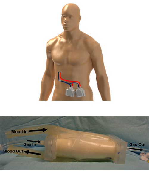 Artificial lung model