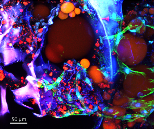 Adipose tissue cultured for 14 days