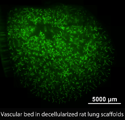 Decellularized lung scaffolds