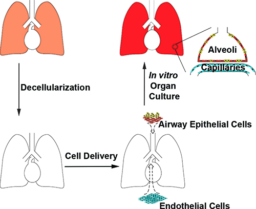 Lung graft diagram