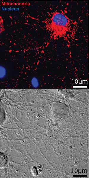 Optical microscope image of neuronal cells on graphene. (Fluorescence was acquired with scanning laser confocal microscope).